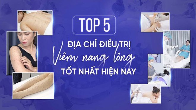 TOP 5 địa chỉ điều trị viêm nang lông tốt nhất hiện nay