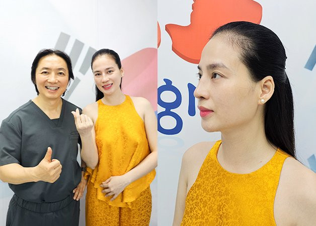 Bệnh viện Kangnam “giải cứu“ mũi hỏng cho cô gái từng nâng mũi tại Hàn Quốc 5 lk